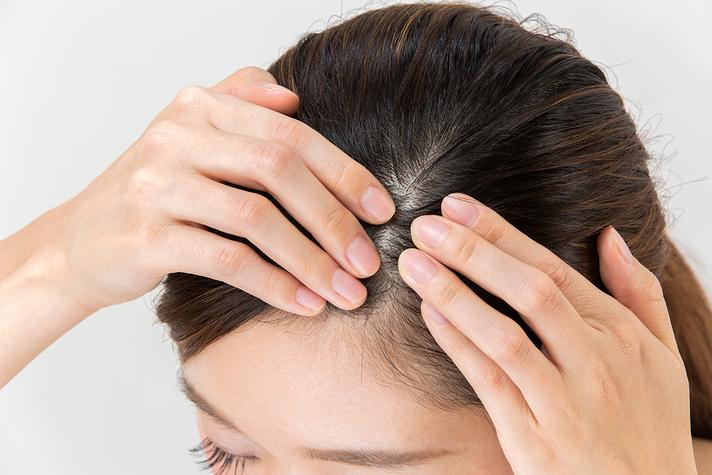 4 Ways to Reverse Hair Follicle Damage 