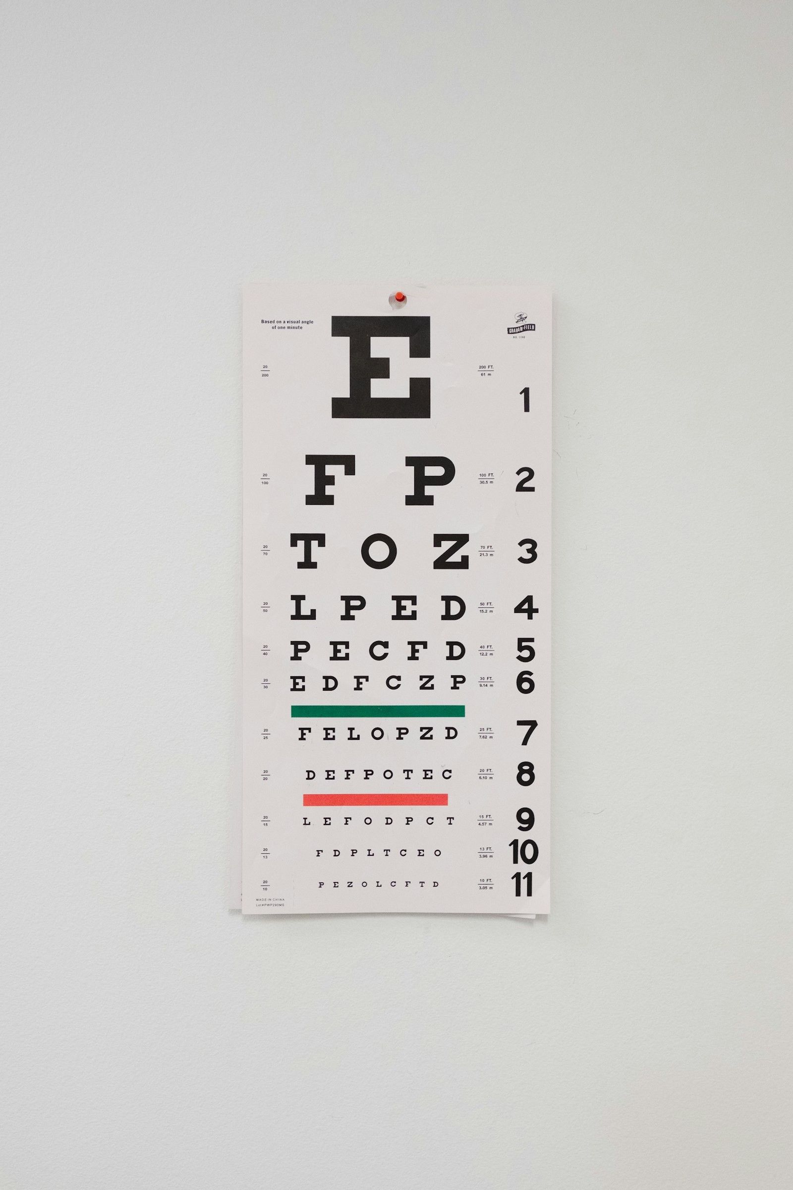 Patient passant un test de vue avec un appareil médical, illustrant les symptômes oculaires après l'éclipse de 2026 qui imposent une consultation