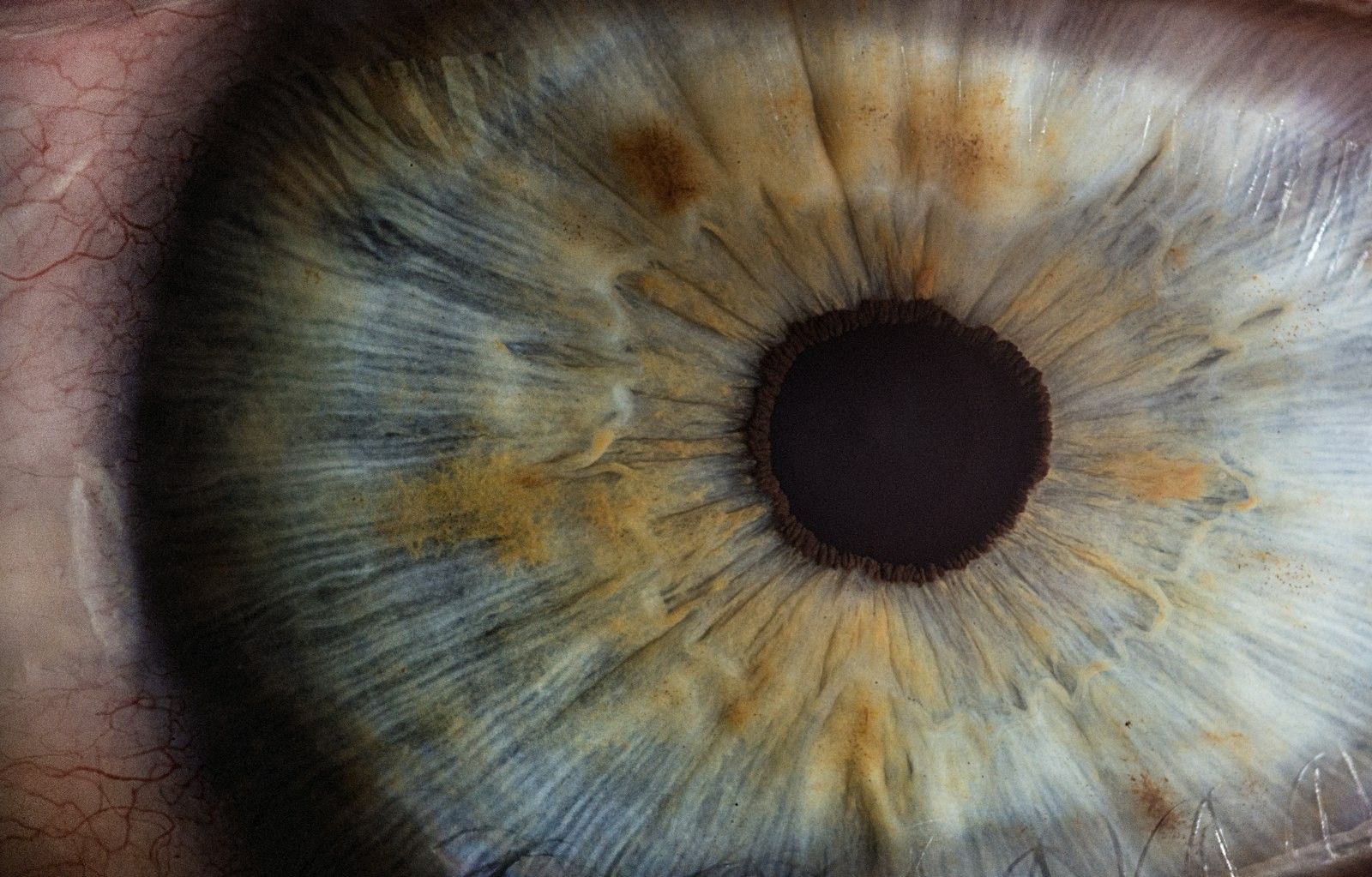 Macro photographie d'un œil humain, illustrant les causes d'une douleur oculaire après l'éclipse solaire