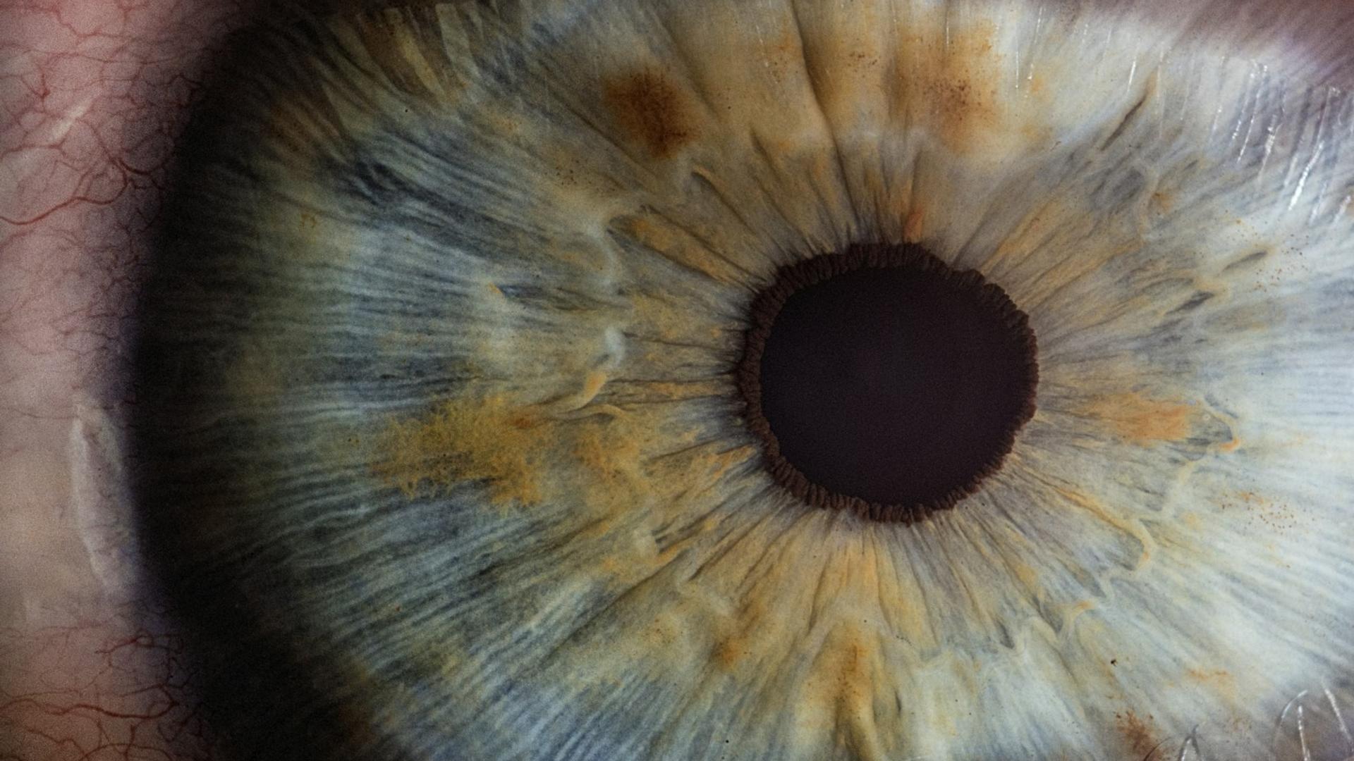 Macro photographie d'un œil humain, illustrant les causes d'une douleur oculaire après l'éclipse solaire