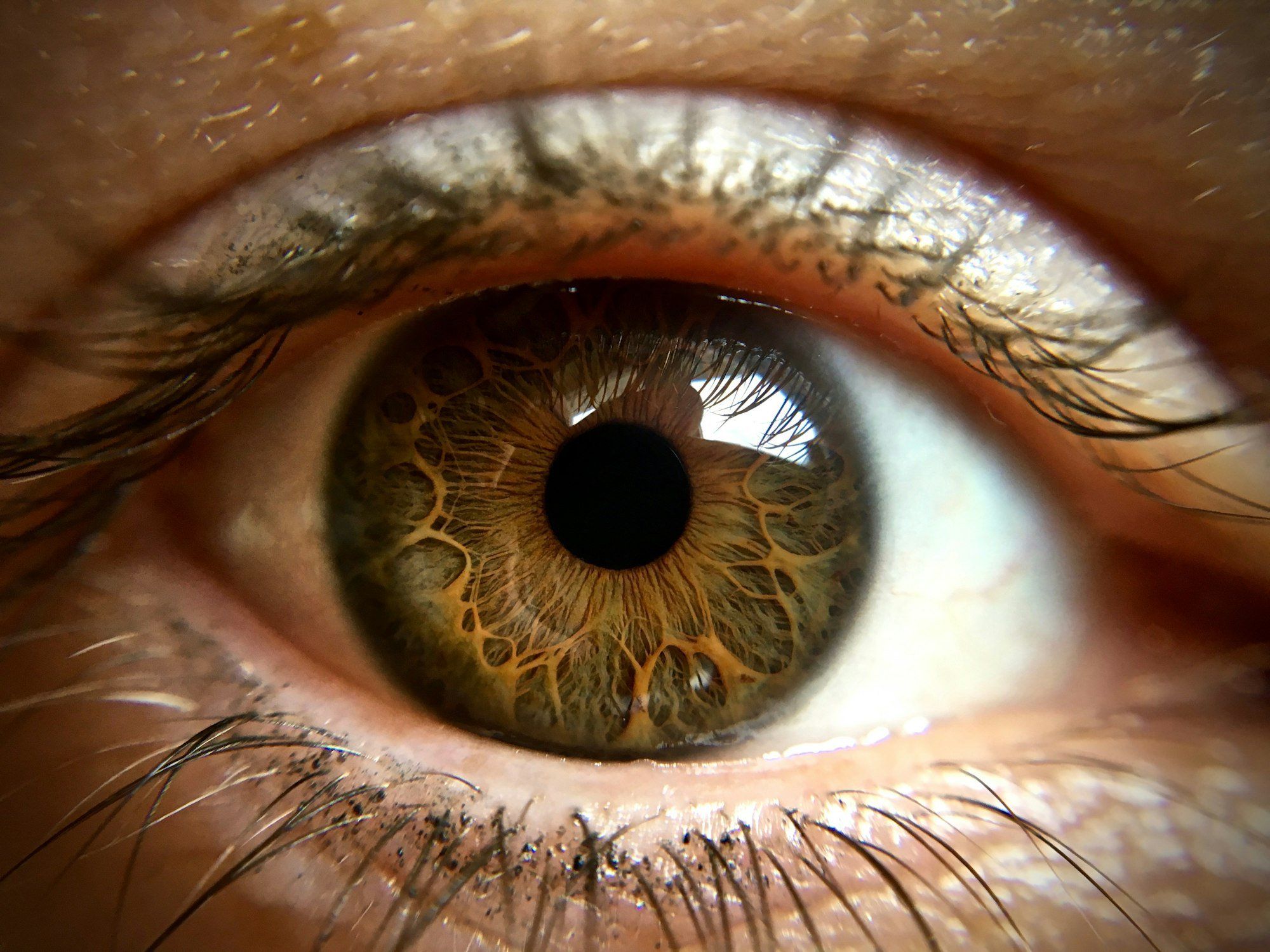 Gros plan sur l'œil d'une personne, pupille et iris bien visibles, illustrant les mouvements involontaires du nystagmus