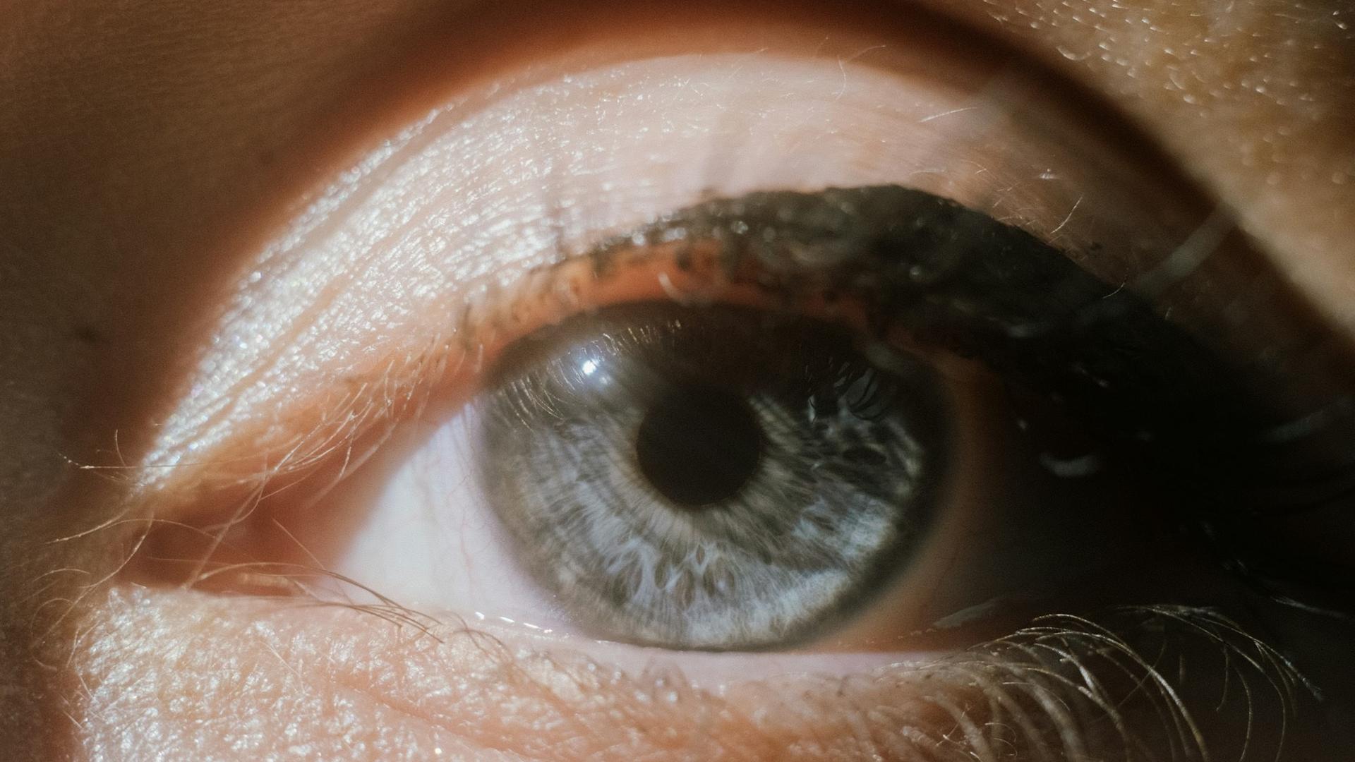 Gros plan sur un œil bleu dont les cils et la paupière sont nettement visibles, la zone touchée par les rougeurs et les squames de la blépharite