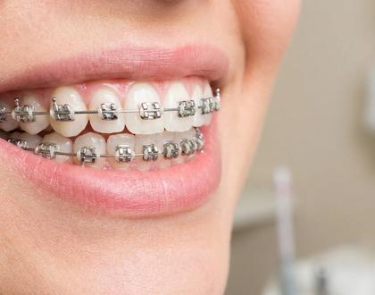 Behel & Orthodonti
