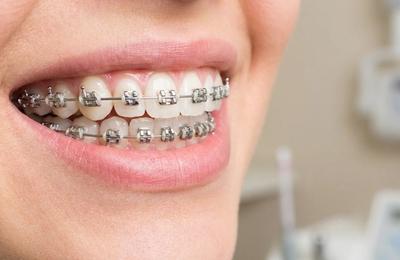 Behel & Orthodonti