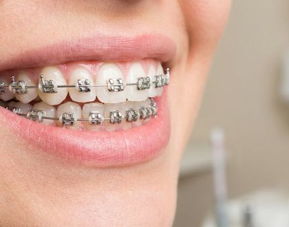 Behel & Orthodonti