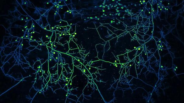 A high resolution mycelial network, with green and glowing threadlike tendrils that split off and branch out into a complex network.
