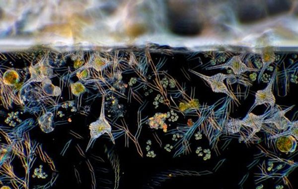 Green, yellow, and translucent microbes float just beneath the surface of the water.