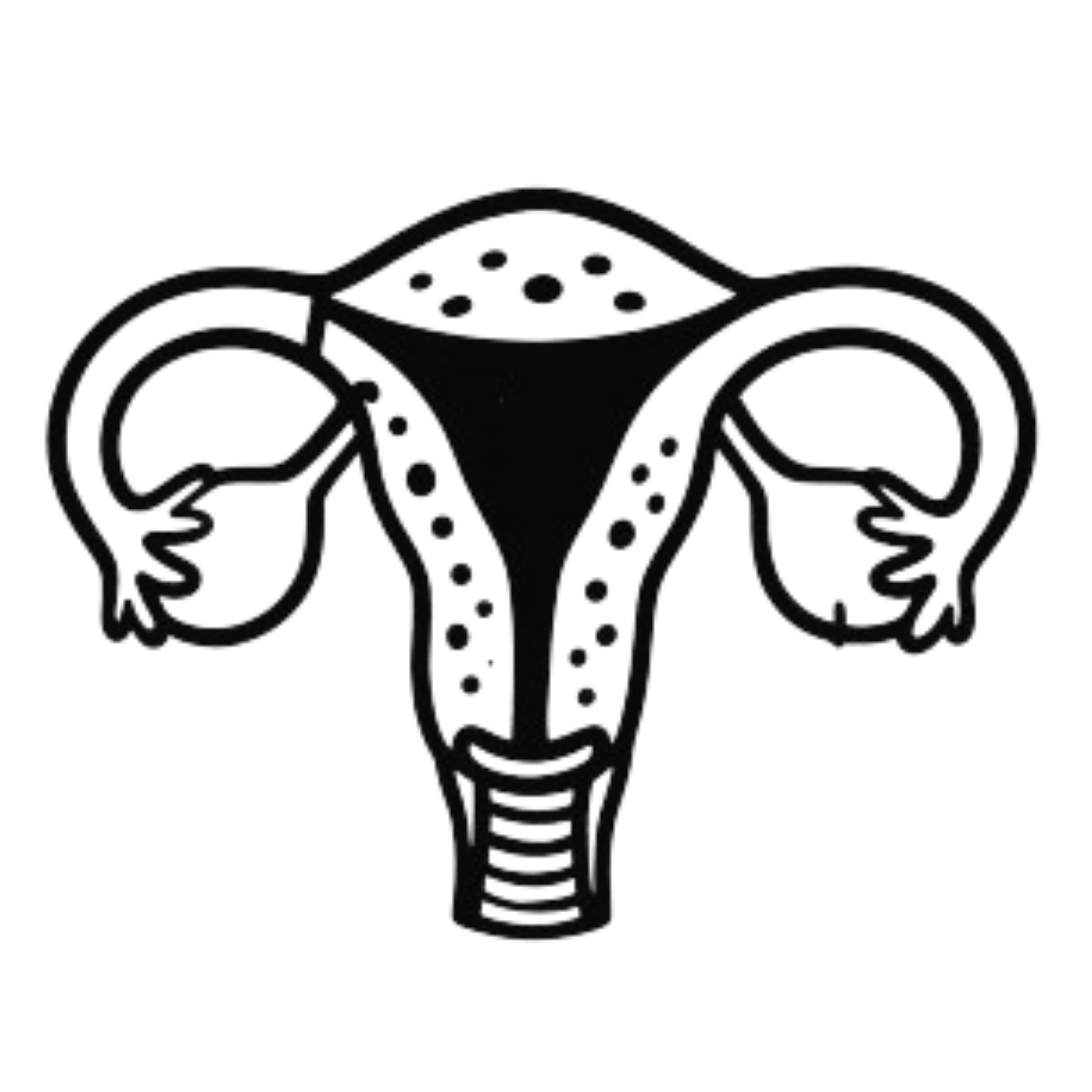 Adenomyosis
