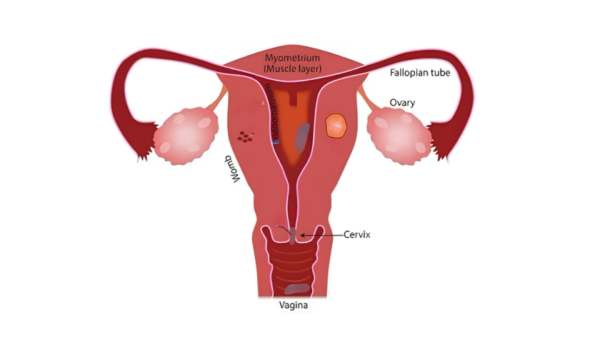 Menstrual disorder treatment by Dr. Ashwani Narla in Hyderabad for regular cycles