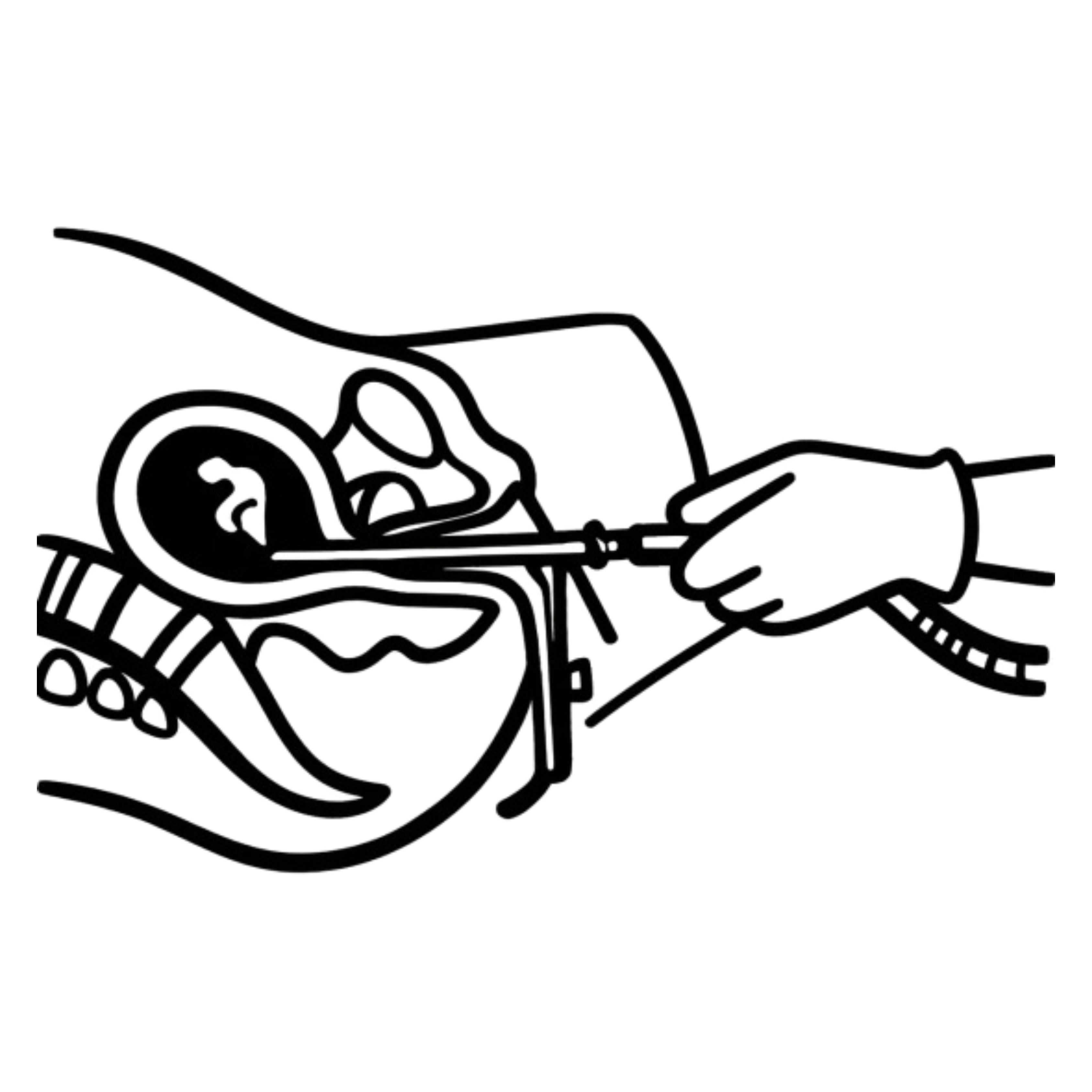 Surgical Abortion