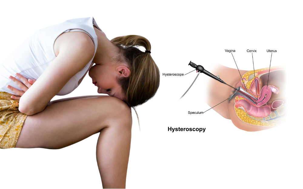Hysteroscopy procedure to examine the inside of the uterus