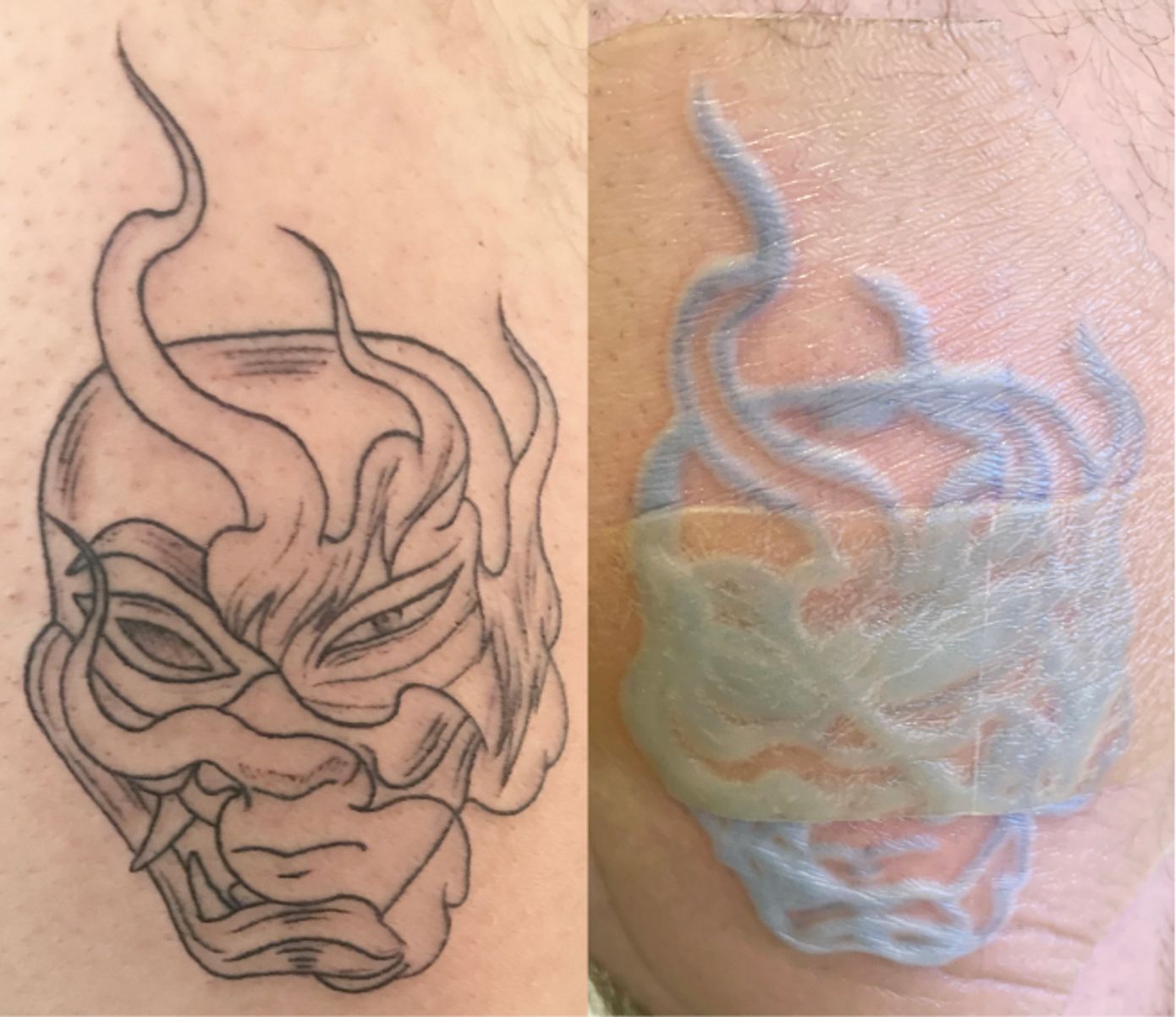 resealing stage of skin healing for temporary tattoo