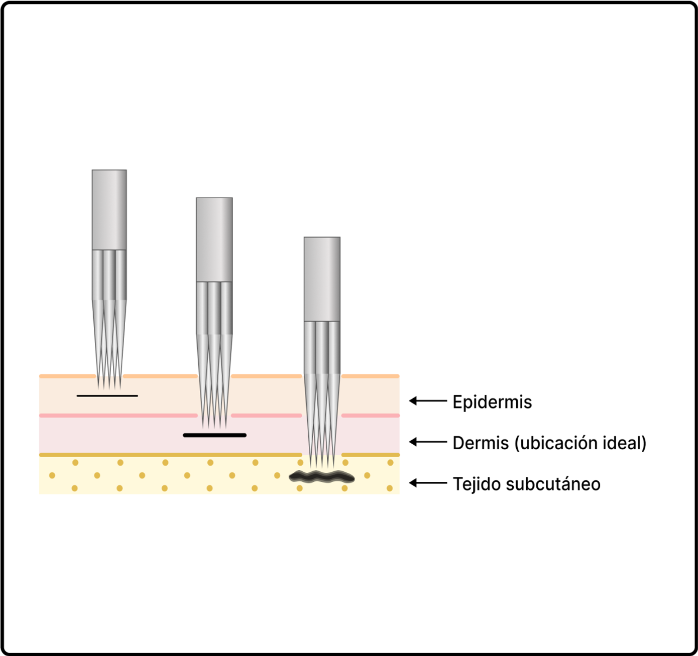 Example of tattoo needle depth