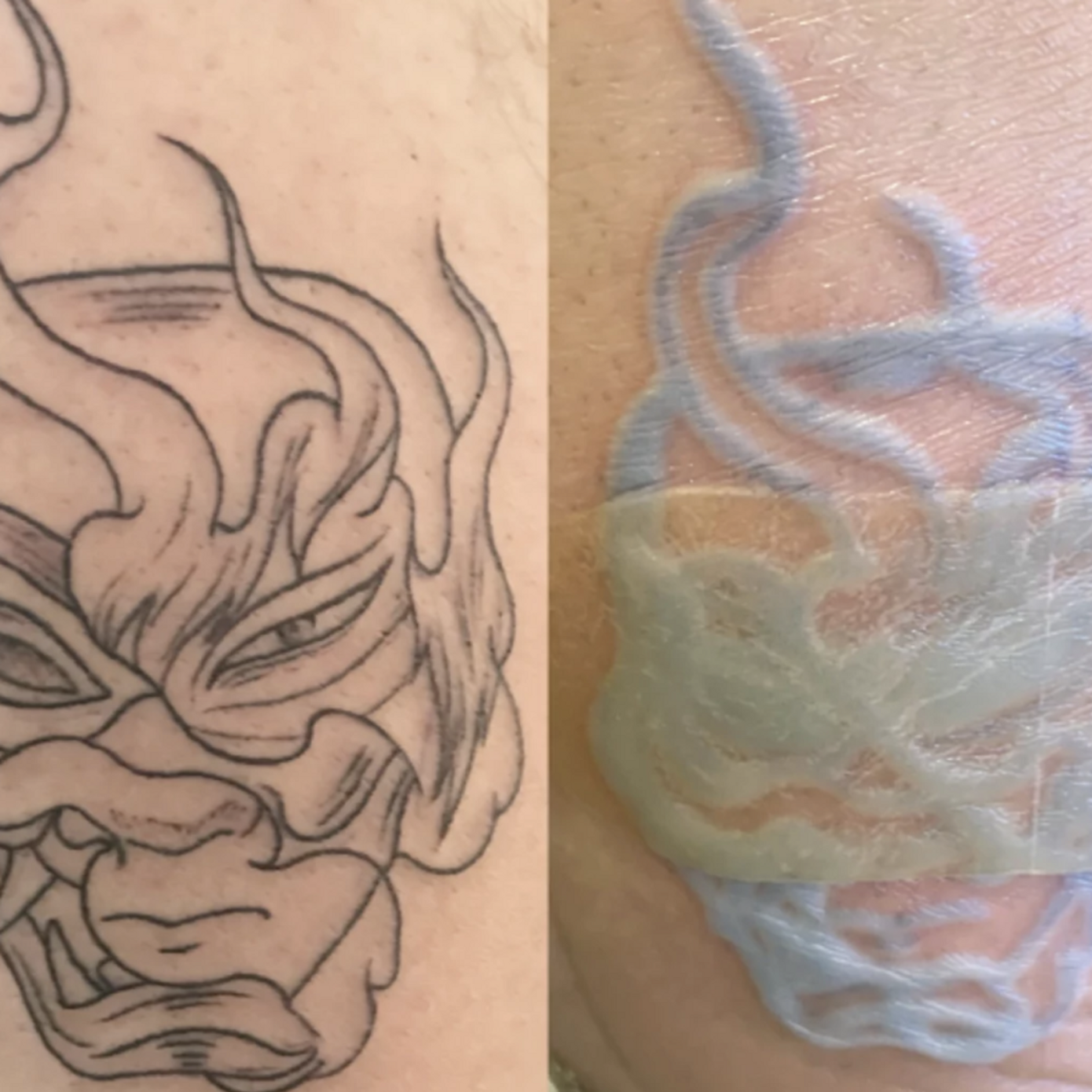 resealing stage of skin healing for temporary tattoo
