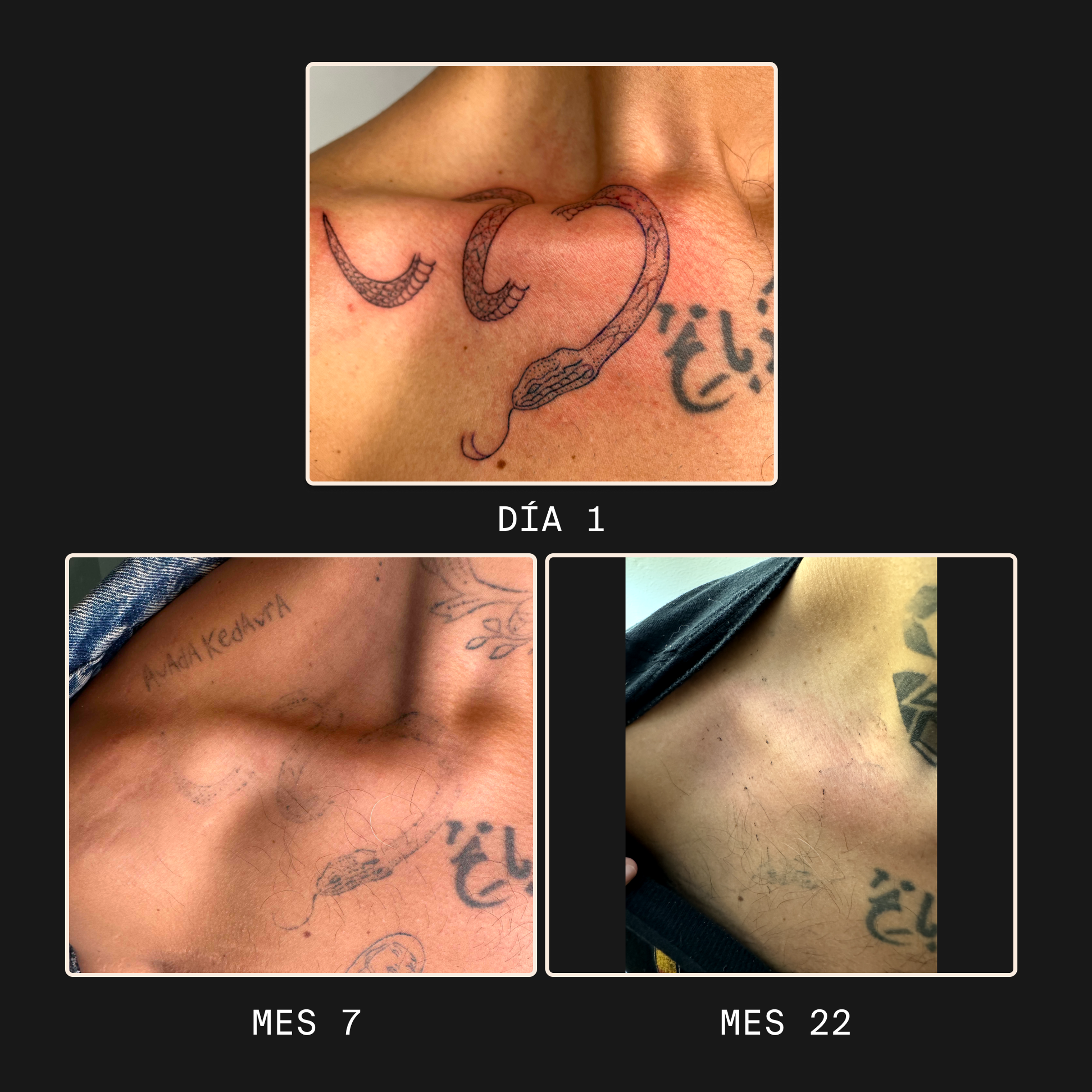 nico ephemerla tattoo