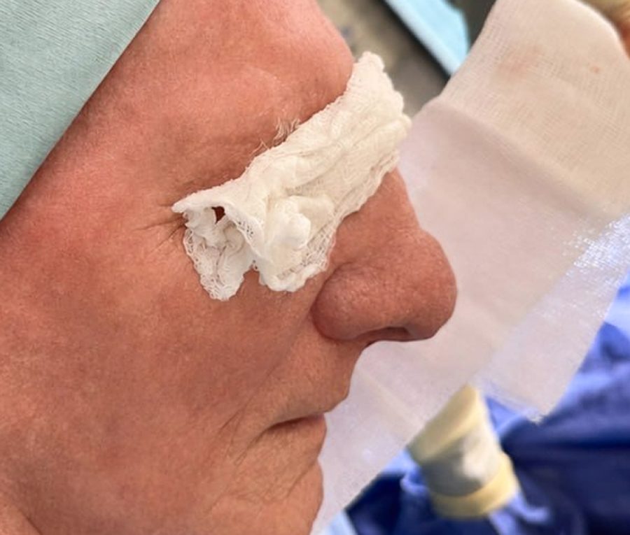 Nose contouring · Patient two, before