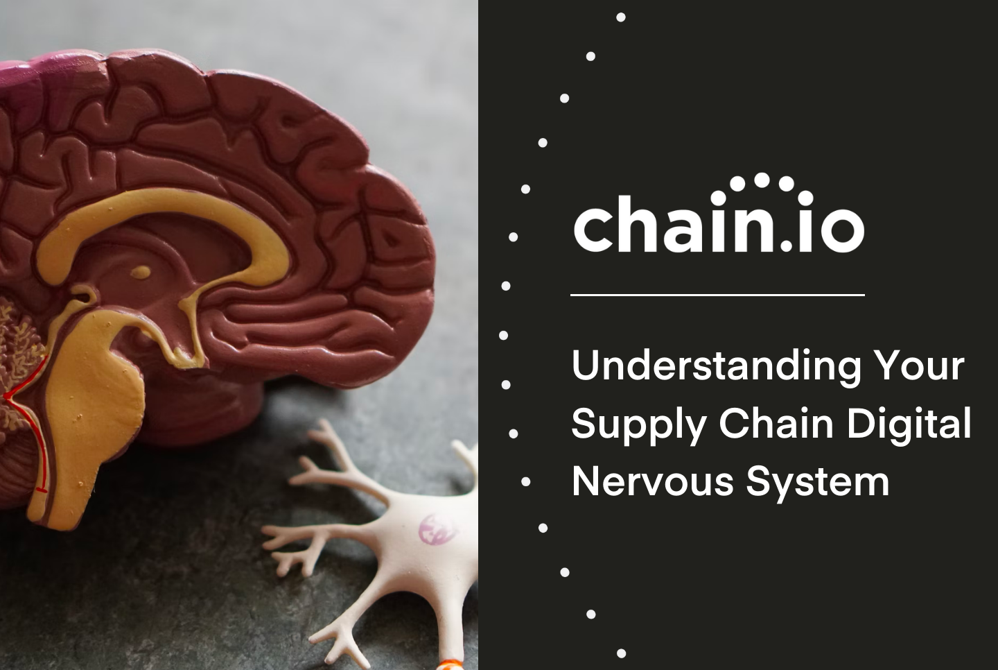 understanding your supply chain digital nervous system