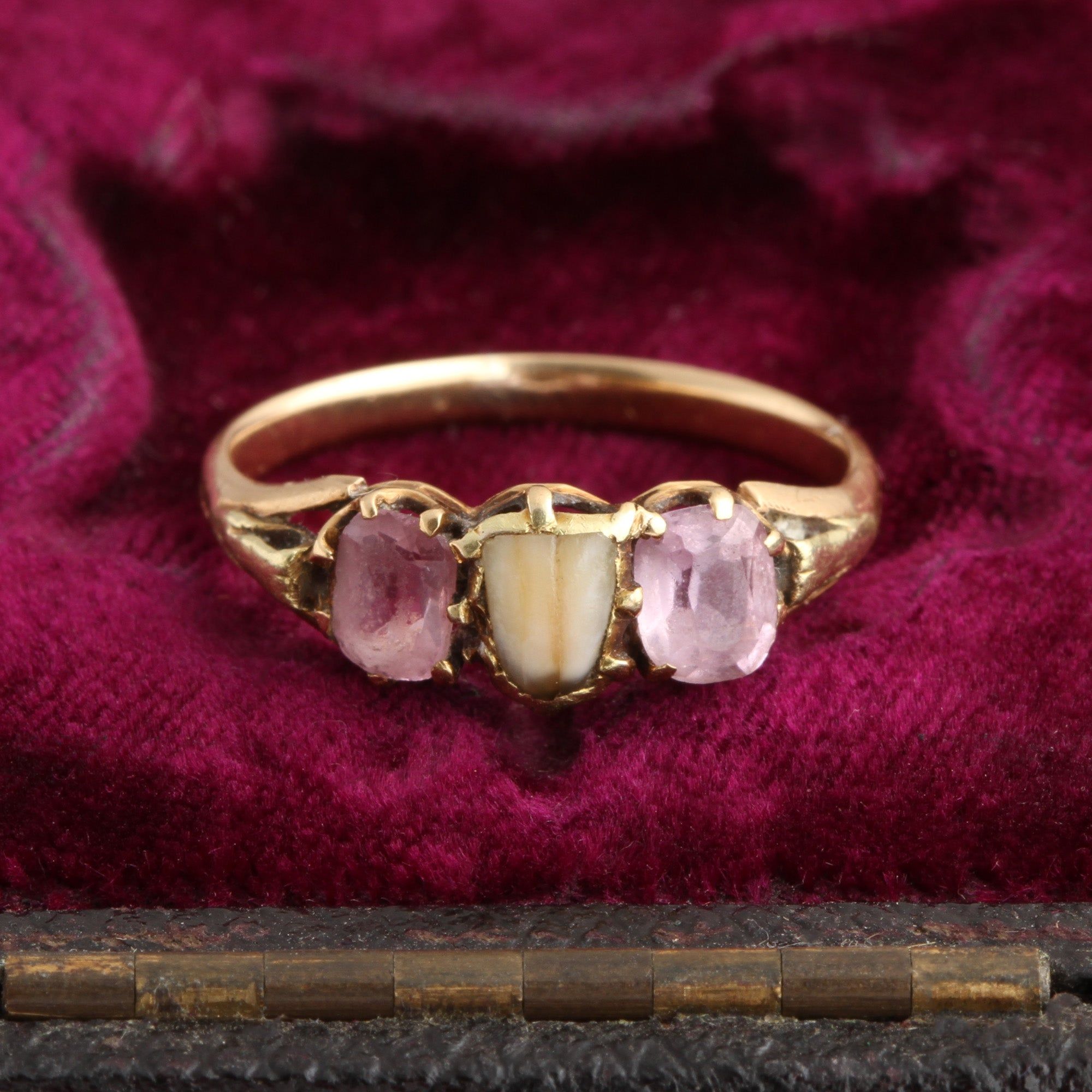 Victorian Milk Tooth Ring