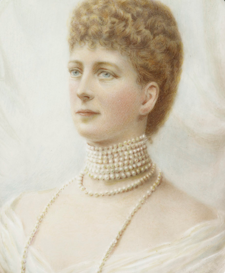Queen Alexandra (wife of Prince Albert and sister of Maria Fyodorovna) was said to have a scar on her neck. She always wore a choker or high collar by William and Daniel Downey.