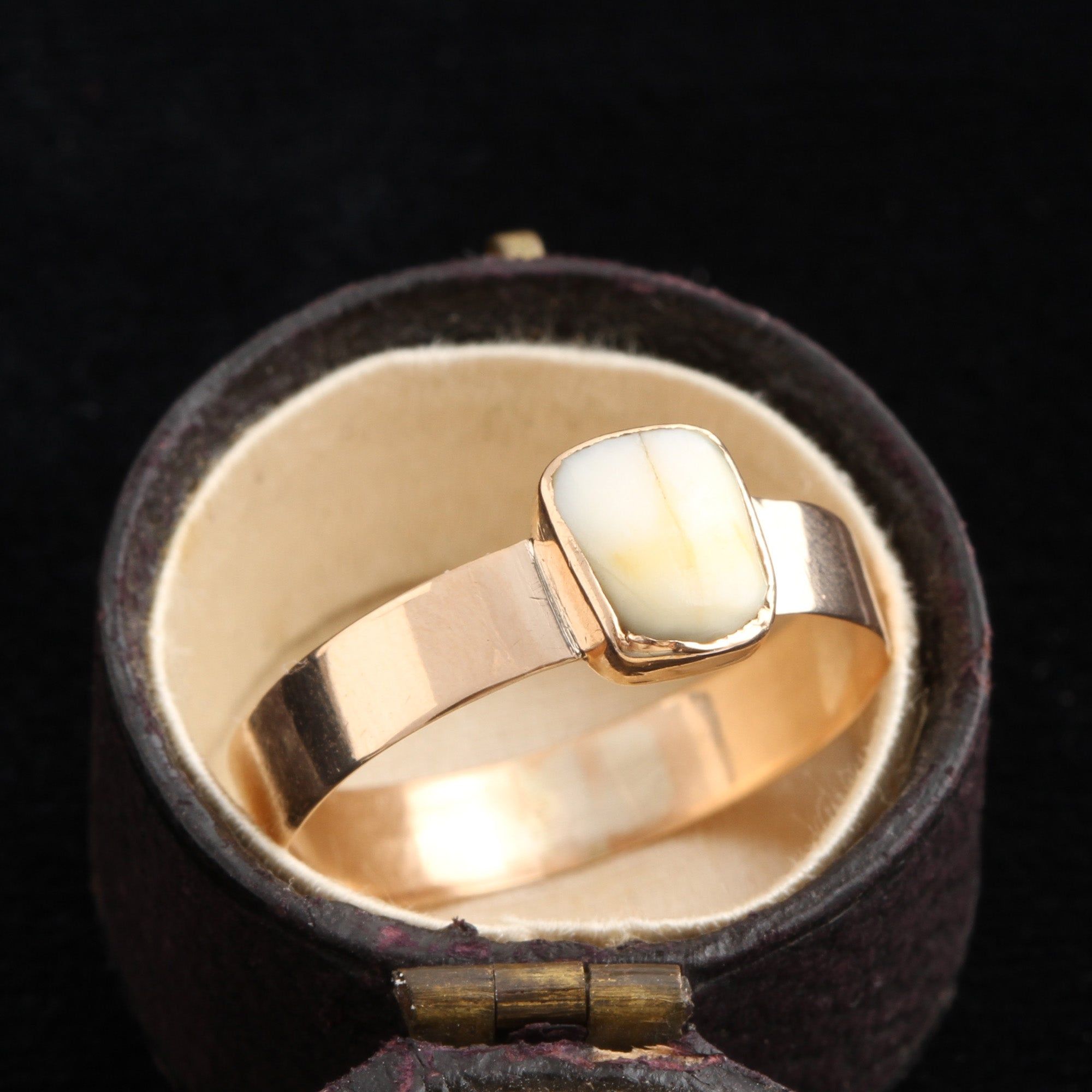 Edwardian Milk Tooth Ring
