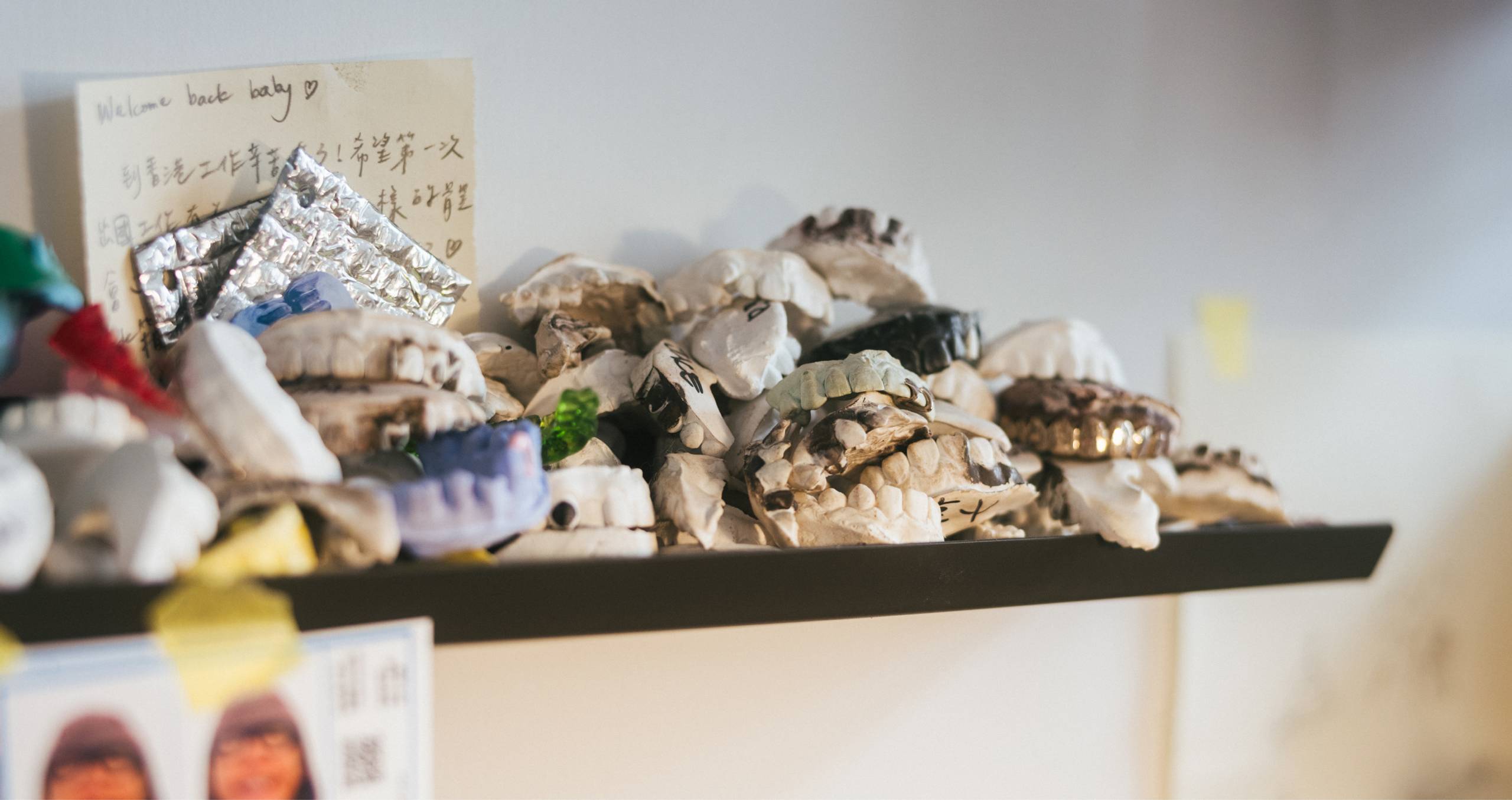 Photo of teeth moldings from jewelry maker Eric Wu's studio