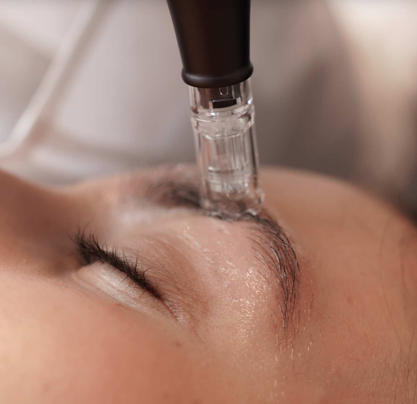 Dodatne prednosti Brow Therapy