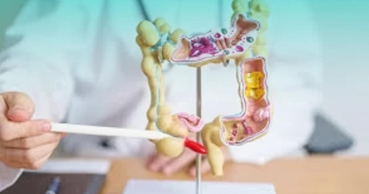 What is Appendicitis? Stages, Symptoms & Treatment | Habilite Clinics