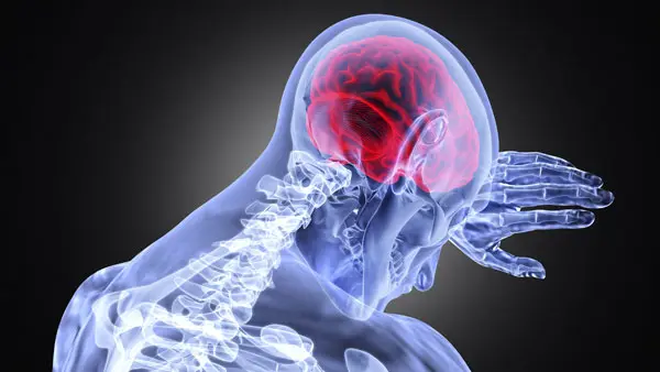 X-ray human view of upper cervical region with neurological concerns