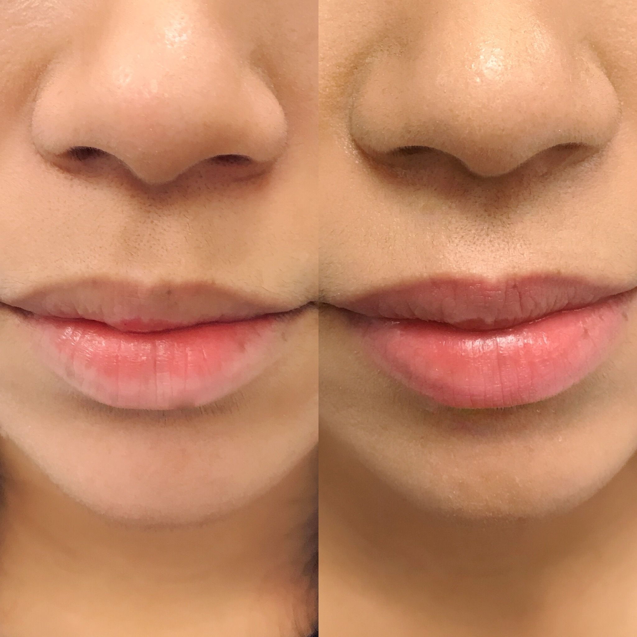 Before and after healed lip blush