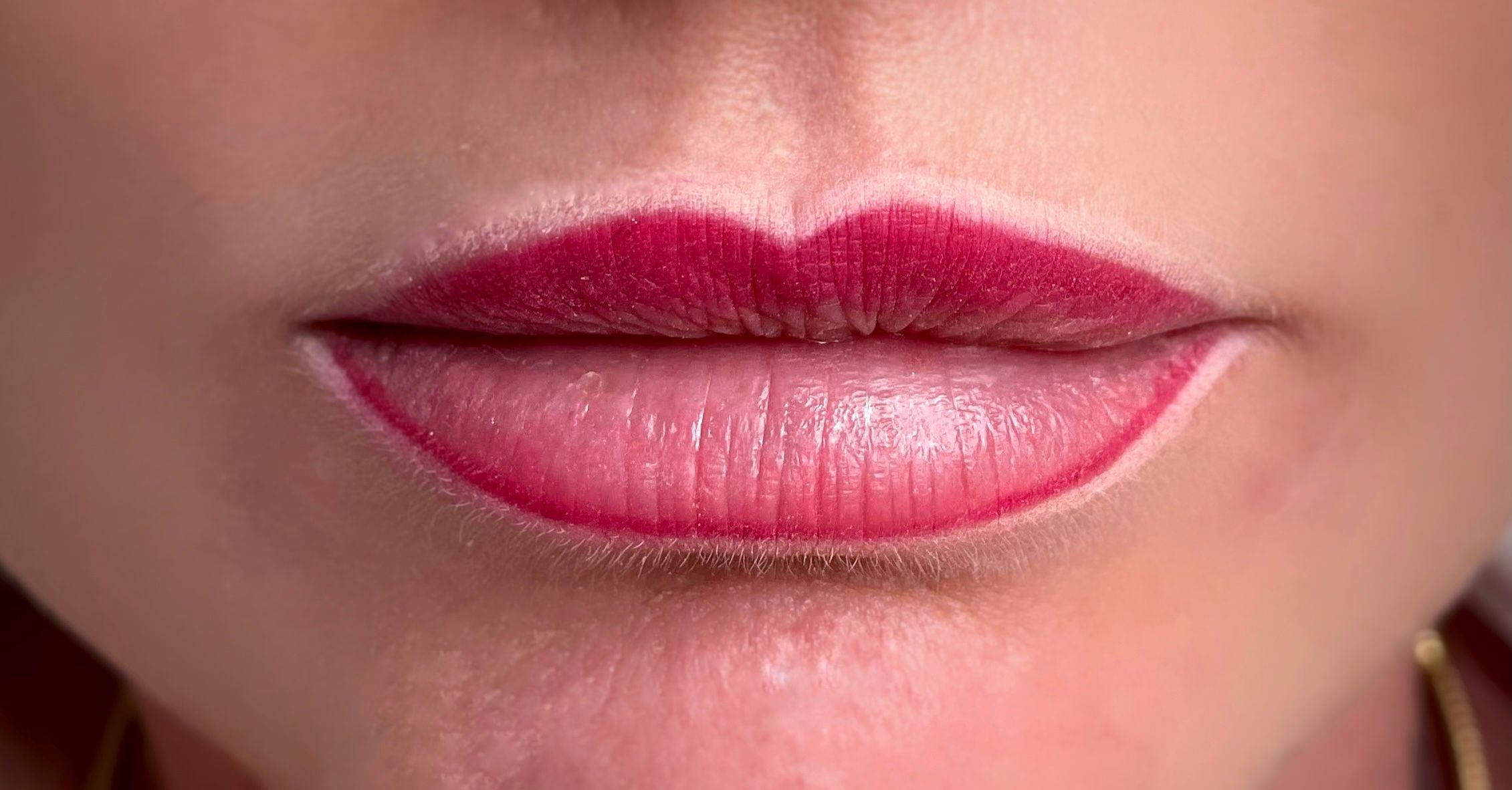 Lip contour before lip blush