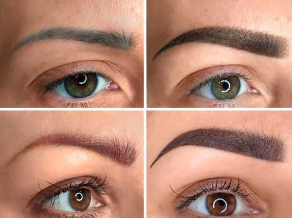 How To Correct Tattooed Eyebrows