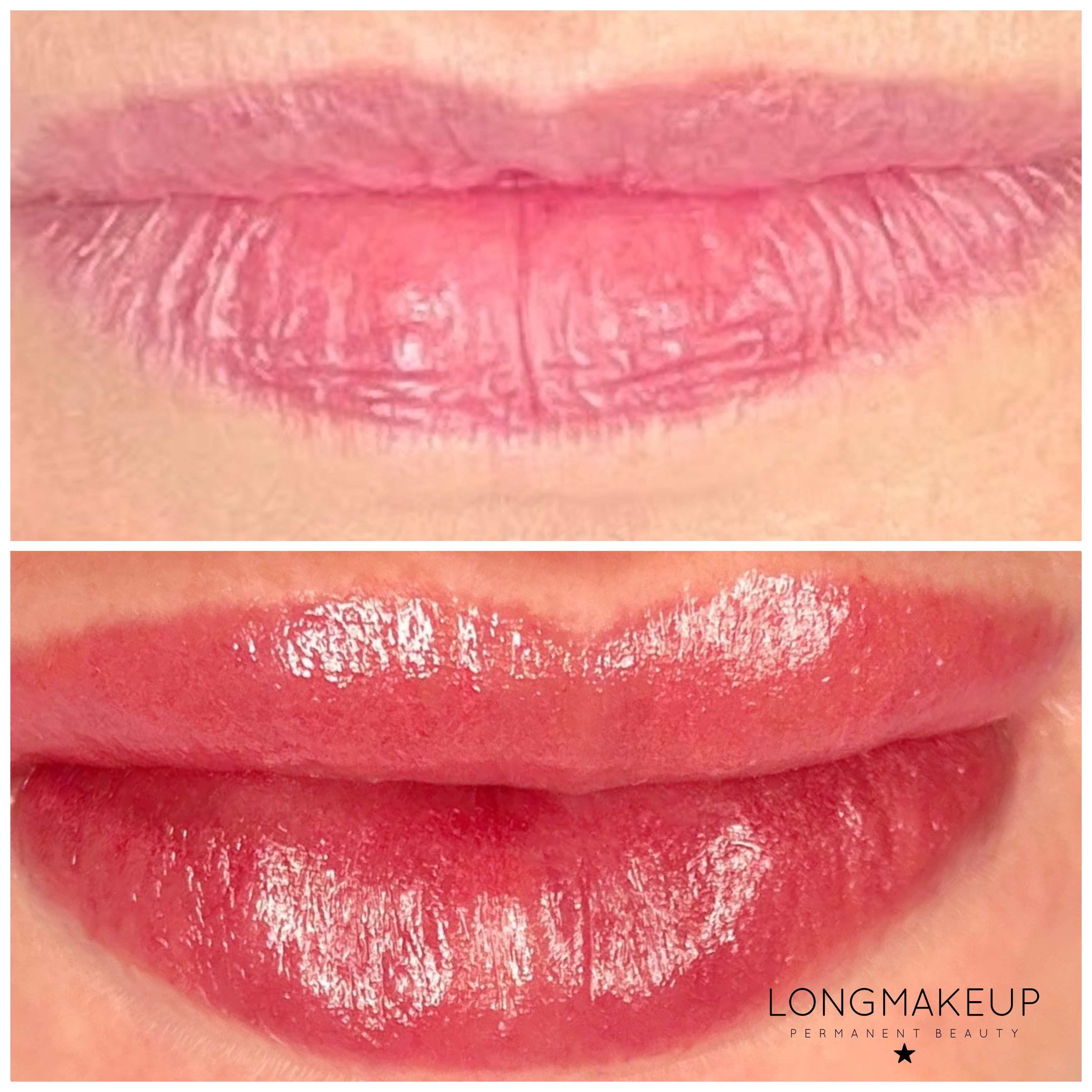 Before and after lip blush