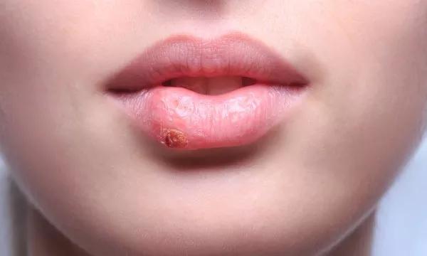 Lip Tattoos - Cosmetic Tattooing Melbourne