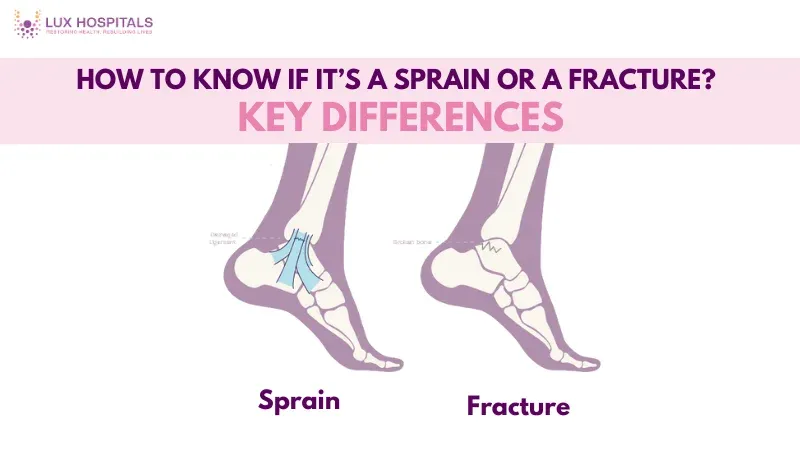 Know If It’s a Sprain