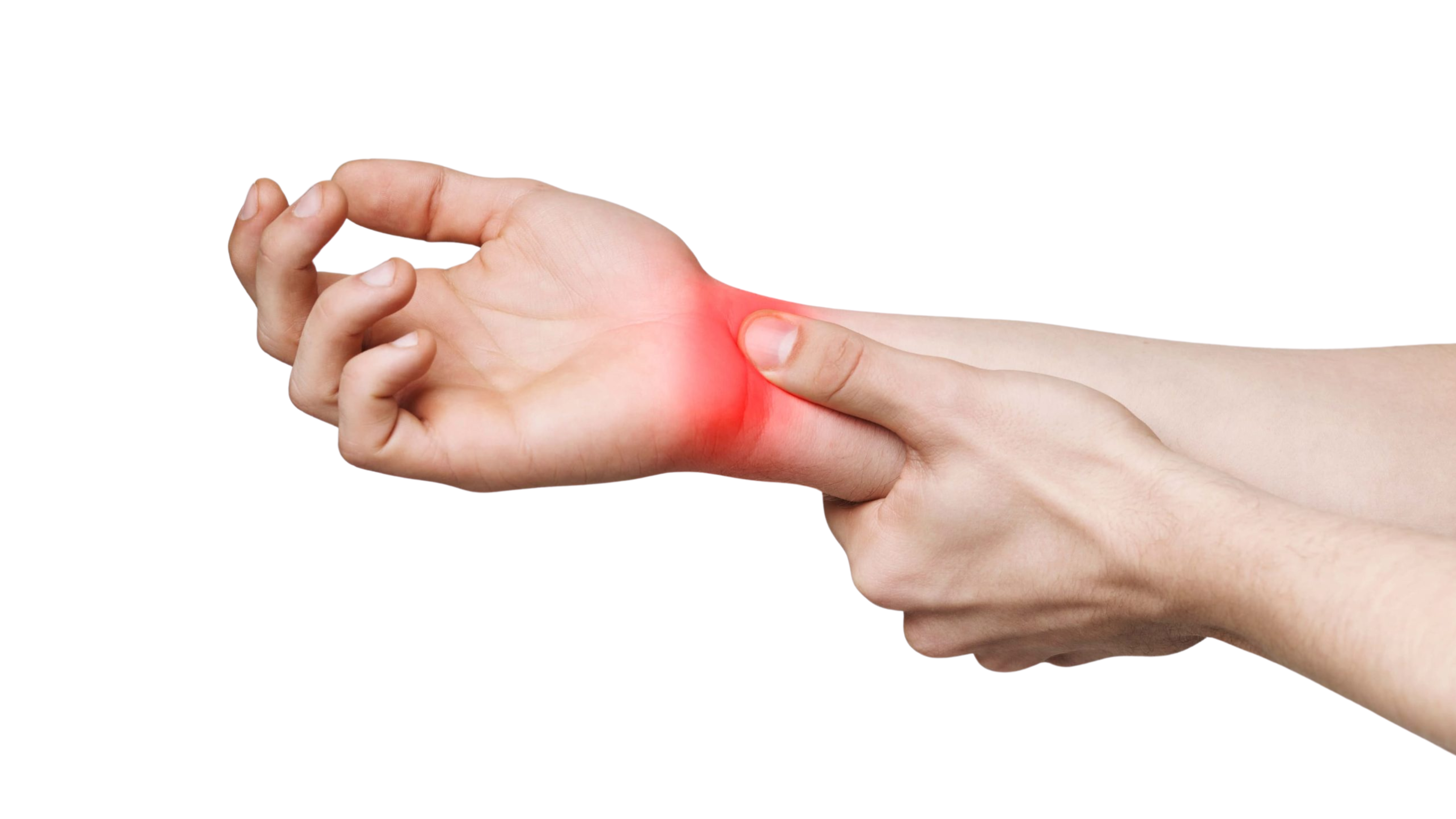 Carpal tunnel syndrome hand and wrist nerve compression illustration at Lux hospitals