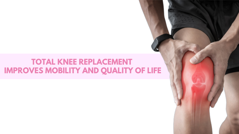 total knee replacement