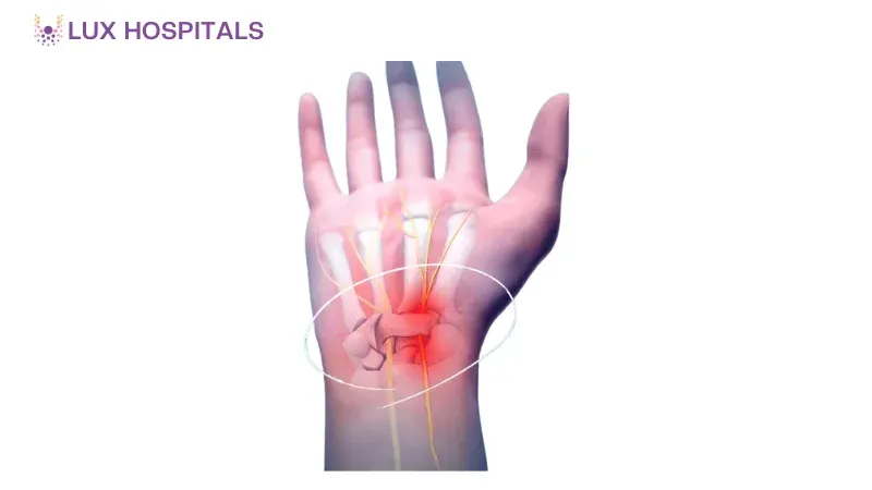 Carpal Tunnel Syndrome Treatment
