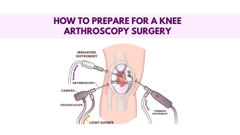 Knee Replacement Surgery