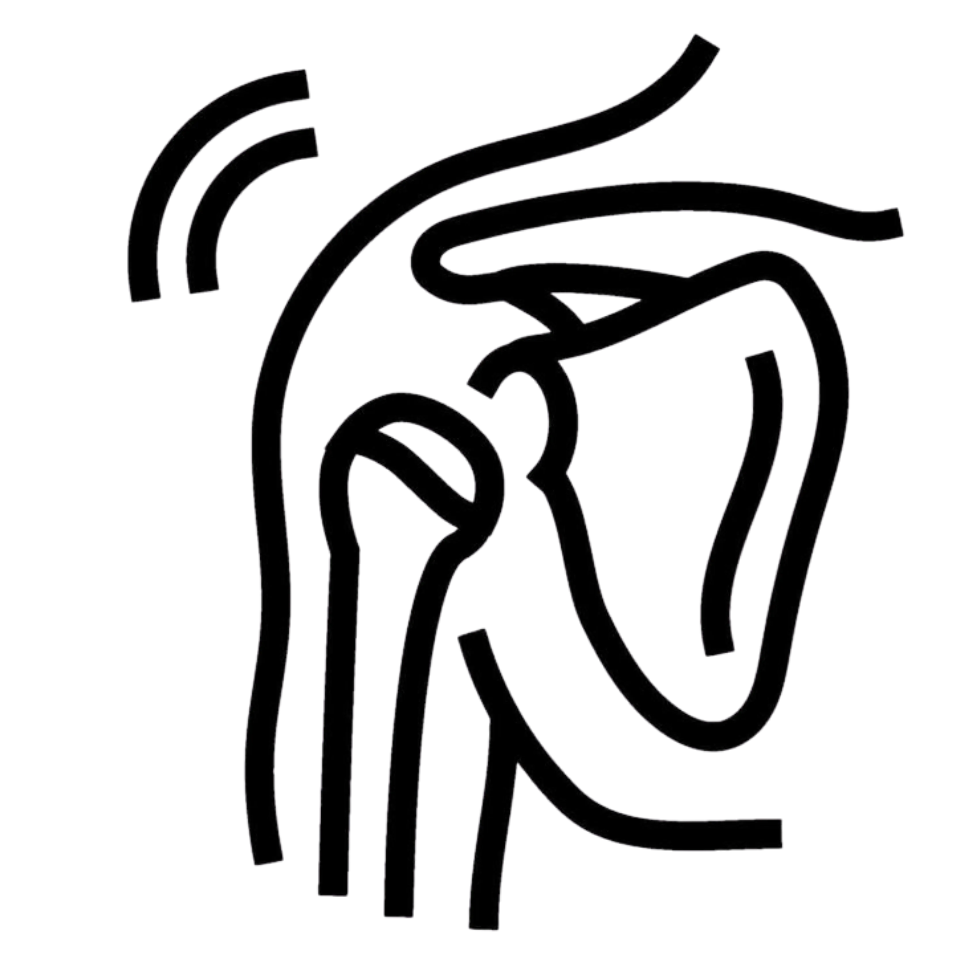 Shoulder Dislocation