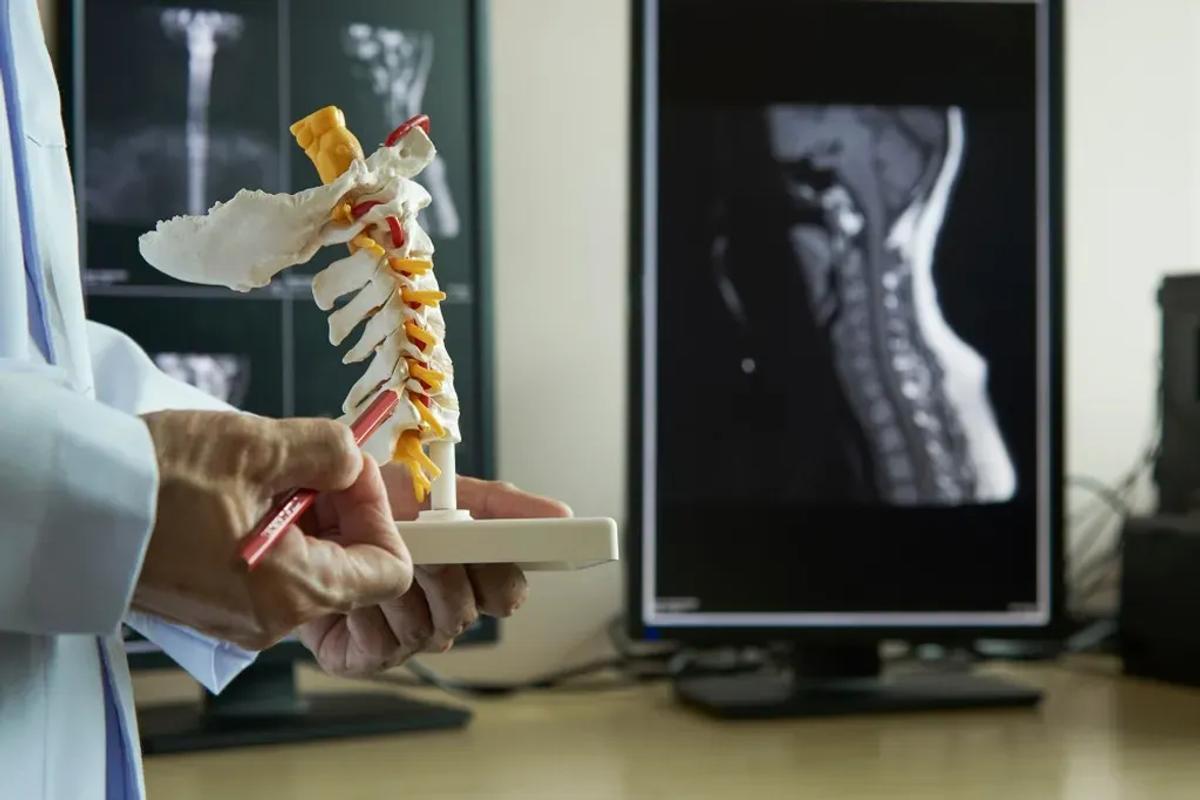 What is Cervical Myelopathy?