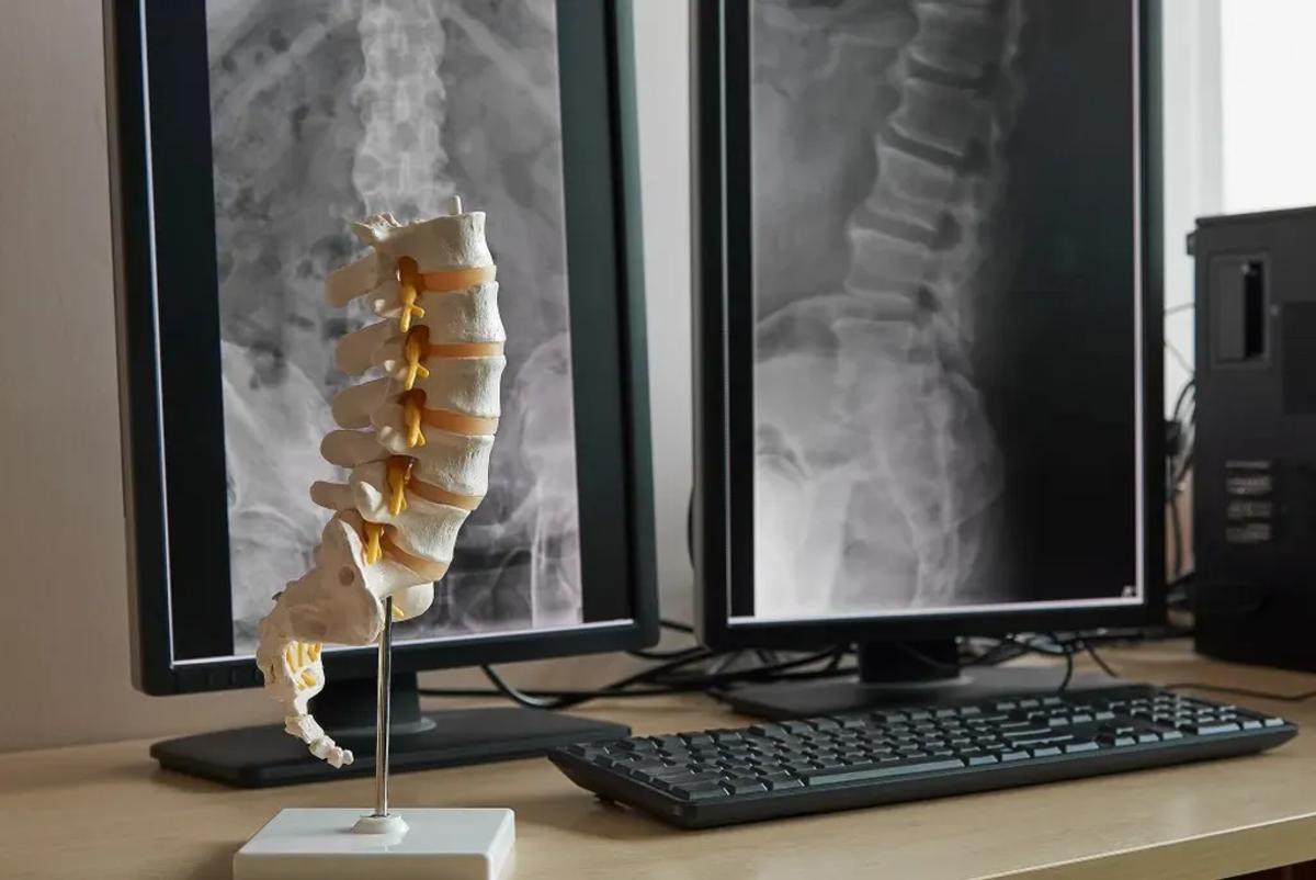 Spine