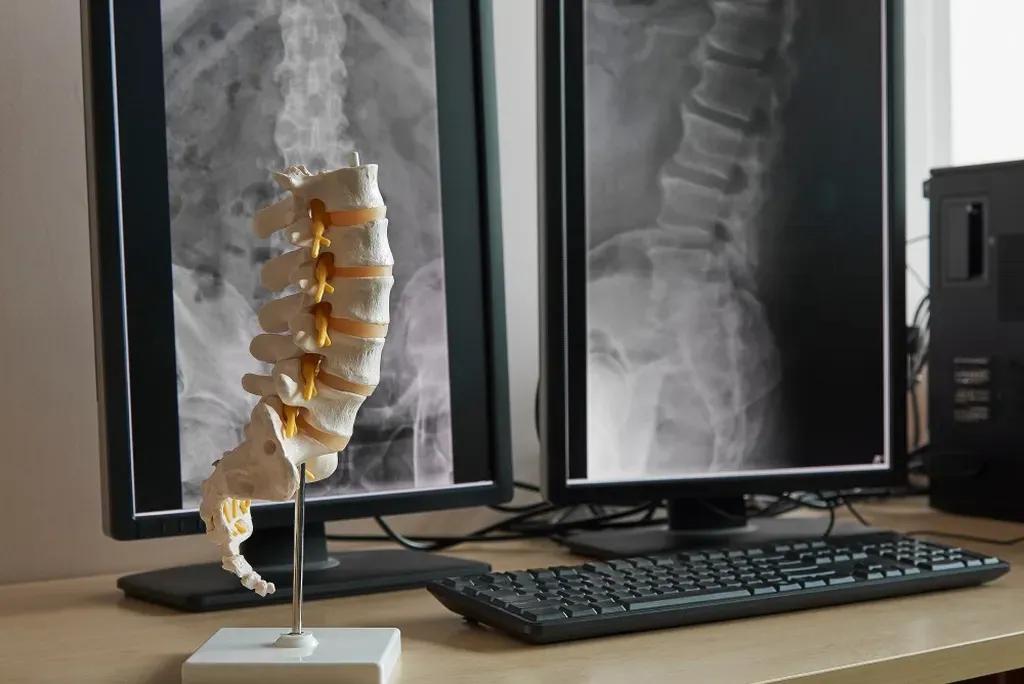 Spine