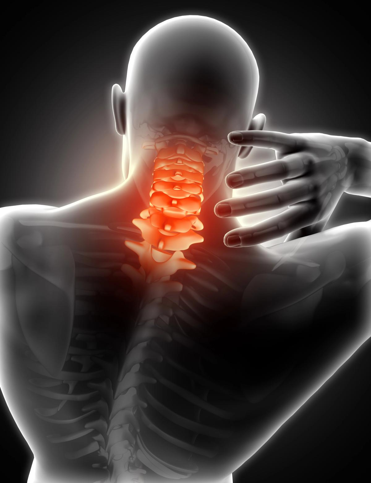 Cervical Disc Replacement