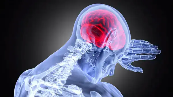 X-ray human view of upper cervical region with neurological concerns