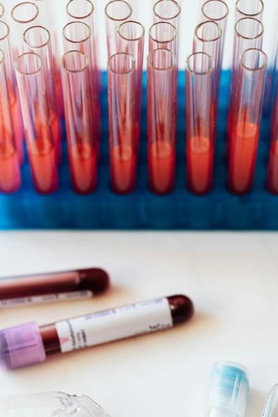 Hematologinės Ligos