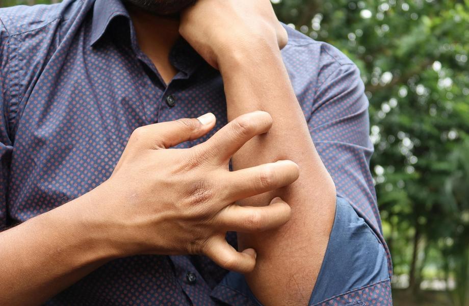 Limfinės sistemos ligos