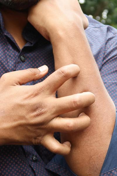 Limfinės Sistemos Ligos