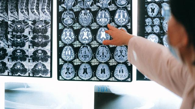 Neurologas