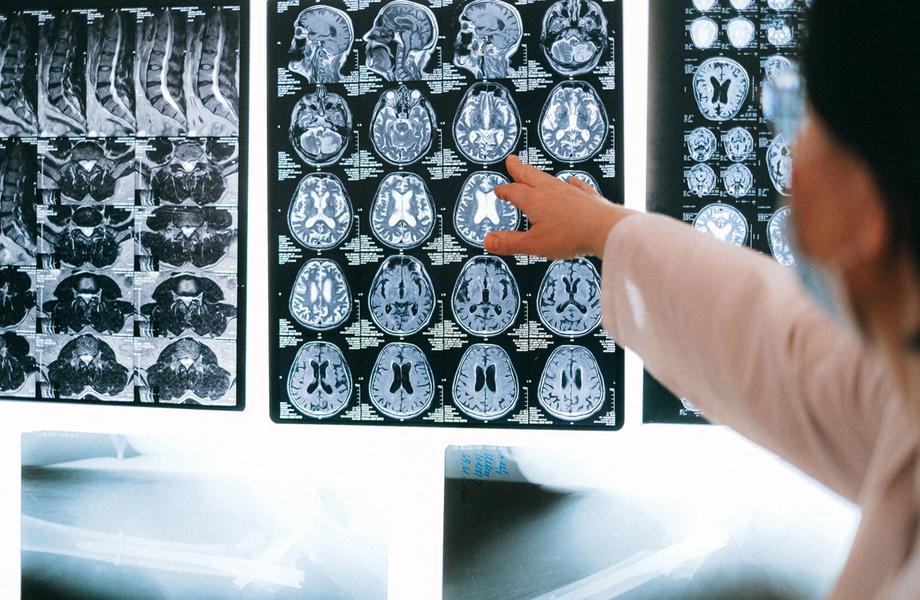 Neurologas