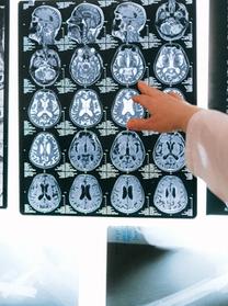 Neurologas